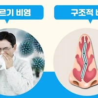 비염 코세척 방법과 코세척 효과 알아보기