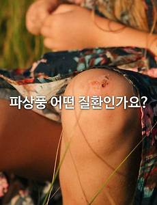 파상풍 어떤 질환인가요?