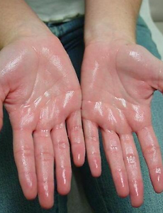 img-skin-thumnail4