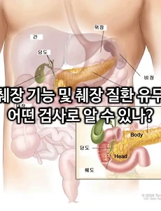 췌장 기능 및 췌장 질환 유무 어떤 검사로 알 수 있나?