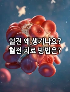 혈전 왜 생기나요? 혈전 치료 방법은?