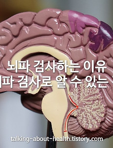 뇌파 검사하는 이유 및 뇌파 검사로 알 수 있는 것