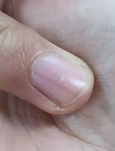 thumbnai5