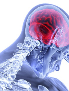 썸네일-뇌졸중의 7가지 초기 증상, 뇌졸중을 빠르게 발견하는 F.A.S.T 방법!