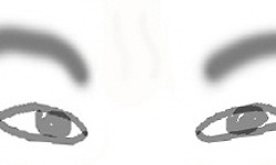 그림일기로 보는 보톡스 부작용