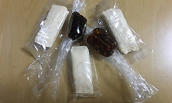 강엿 먹다가 임플란트 이빨 빠졌어요.