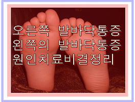 썸네일링크