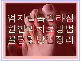 썸네일링크
