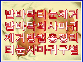 썸네일링크