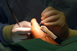 요양병원 입원 대상 및 비용 지원 방법 알아보기 썸네일