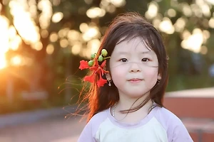 머리 심기 전 필수 체크사항과 평균 시술 비용 완벽 분석 썸네일