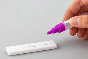 HIV 검사란 무엇인가? 검사 방법과 결과 해석 썸네일
