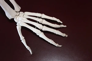 관절염과 유사한 질환 구별하는 방법 총정리 썸네일