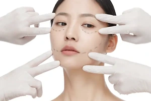 성형수술 후 회복 관리 팁: 부작용을 예방하는 방법 썸네일