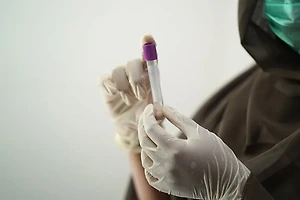 HIV 검사 전 준비사항과 결과 대처 방법 썸네일