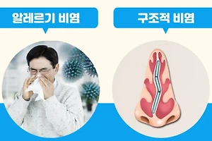 비염 코세척 방법과 코세척 효과 알아보기 썸네일