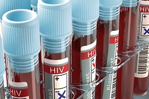 HIV 바이러스 치료제와 증상 알아보기 썸네일