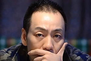 자라나라 머리머리, 탈모인을 위한 모발 이식 비용은 얼마? 썸네일
