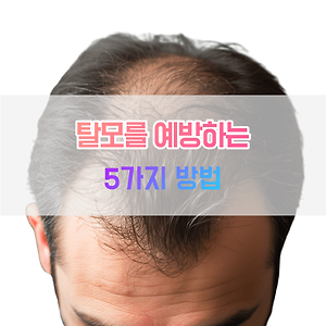 기사-대표-썸네일