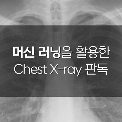 [Hi-tech] 머신 러닝을 활용한 흉부 X-ray 판독