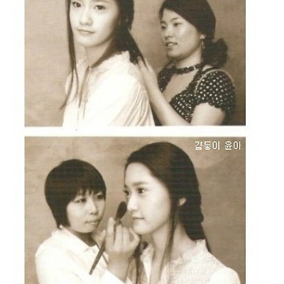 윤아 성형전 루머,턱성형?양약수술? 진실파헤치기