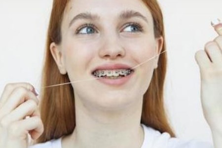치아 교정 중에 양치질? 치간칫솔과 치실 이용 방법