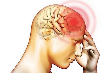 바이러스성 뇌수막염 증상 및 원인