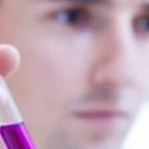 2012th 현재 가격 GDP는 17.0 억 유로했습니다.