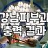 압구정로데오성형외과 선택 전 반드시 확인해야 할 5가지 체크포인트