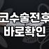 코성형후기 볼 때 주의해야 할 수술 후 실제 회복 과정과 체크리스트