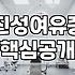 여유증, 운동으로 정말 해결될까? 현직 30대의 솔직한 경험담
