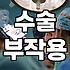 성형정보 확인 시 반드시 고려해야 할 수술 부작용과 회복 기간