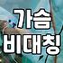 짝가슴, 수술만이 답일까? 현실적인 고민과 선택지들