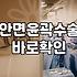 페이스라인성형 수술 전 반드시 확인해야 할 부작용과 회복 기간