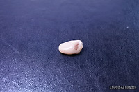 보청기 소리가 작아졌다면?