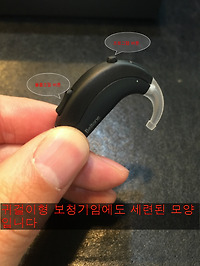 귀걸이형보청기 착용 사례 [벨톤보청기 / 인천보청기]