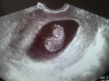 도연이 Begins 1 of 2