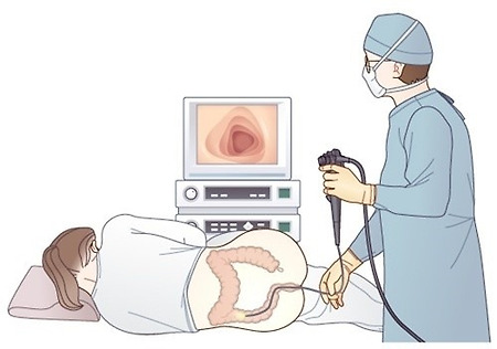 처음으로 대장내시경을 받다..
