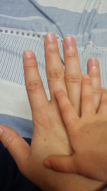 손등에 점이 똑같다?!