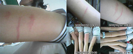 초등학생들의 ‘칼빵문화’... 알고 계세요?