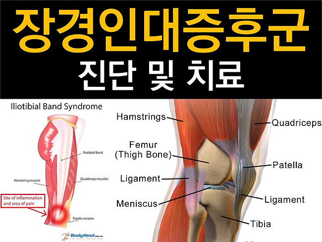 허벅지 bursa 자전거